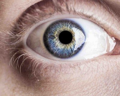 What Is An Eye Emergency?
