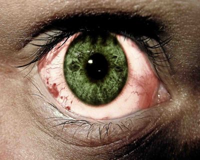 What are the symptoms for Red Eyes?